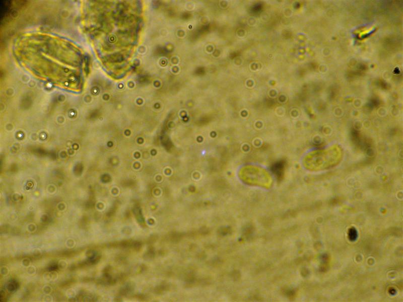 Crosta da determinare (Peniophora incarnata)